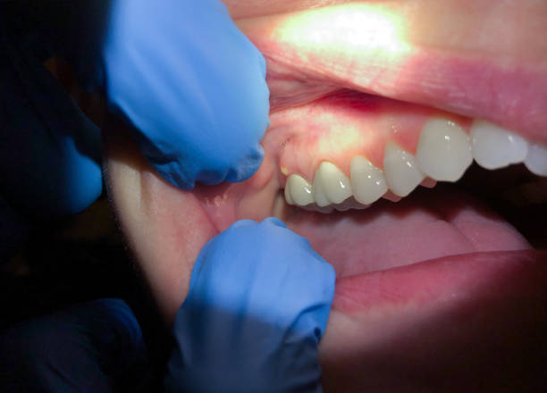 Best Emergency Treatment for Oral Infections in Monona, IA